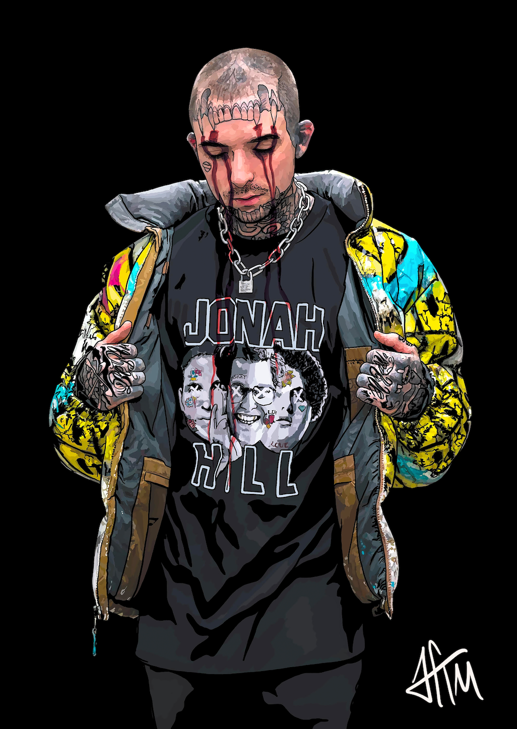 CASKEY